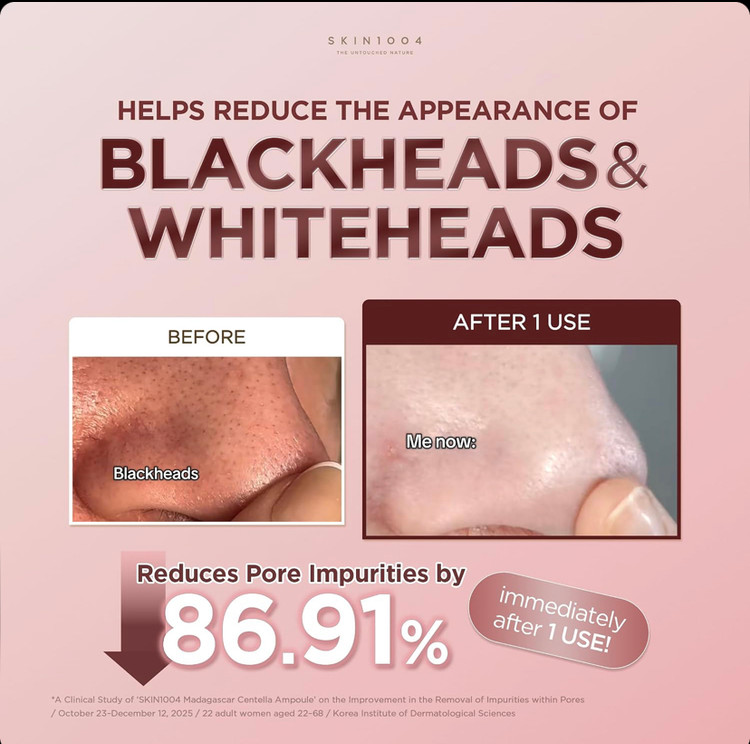 ماسک استیکی خاک رس کنترل منافذ سنتلا اسکین 1004 Skin 1004 Centella حجم 27 گرم
