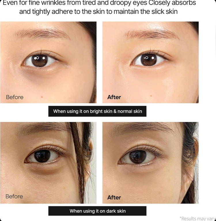 کرم دور چشم ضدلک کلسیم دکتر ملاکسین Dr. Melaxin Calcium Dark Spot Cover Eye Cream حجم 15 گرم