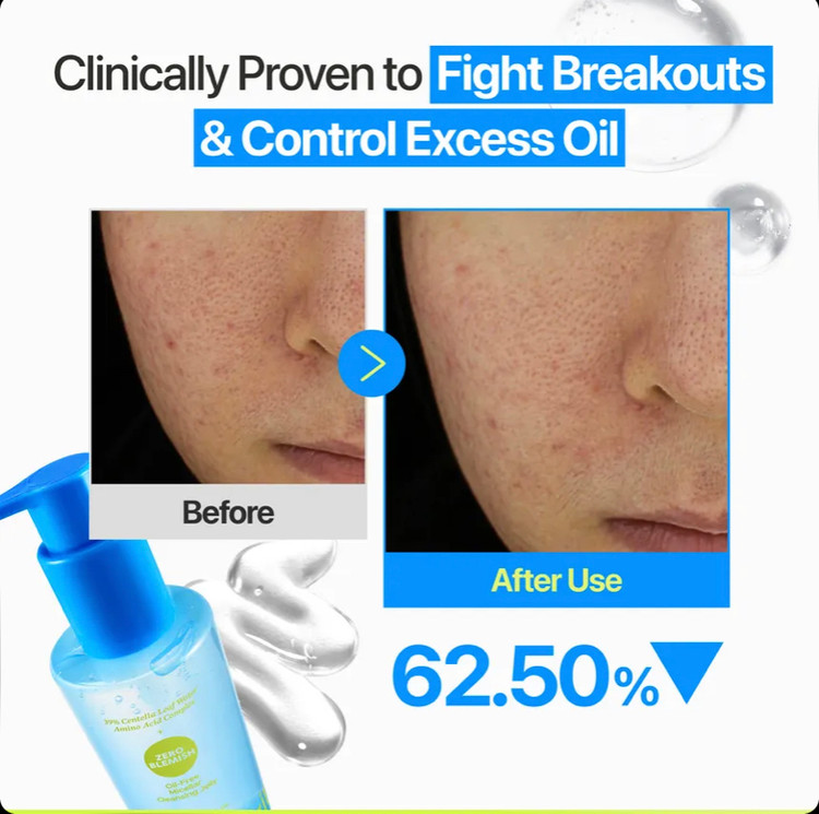 ژل میسلار پاککننده صورت بدون چربی نامبوزین Numbuzin Zero Blemish مناسب پوست مستعد جوش حجم 200 میل