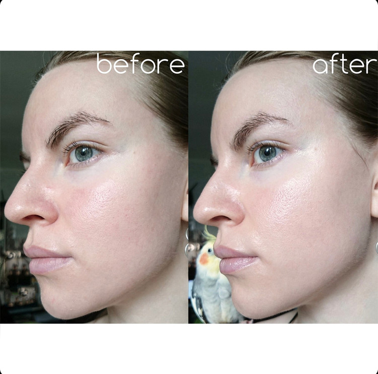 تونر ترمیم کننده و جوانساز سنتلا اسکین 1004 SKIN 1004 CENTELLA حجم 210 میل